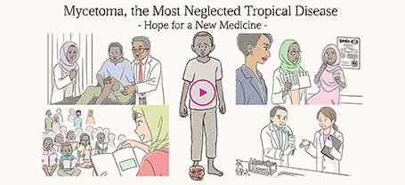 Mycetoma, the Most Neglected Tropical Disease -Hope for a New Medicine-