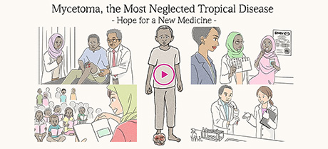 Mycetoma, the Most Neglected Tropical Disease -Hope for a New Medicine-