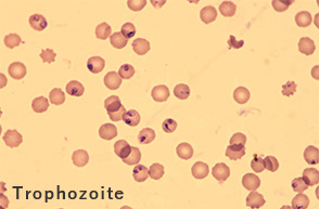 Joint Research Paper on Antimalarial Medicine by Broad Institute and Eisai Published in Nature
 - A Report Shows New Step Forward for Development of New Antimalarials